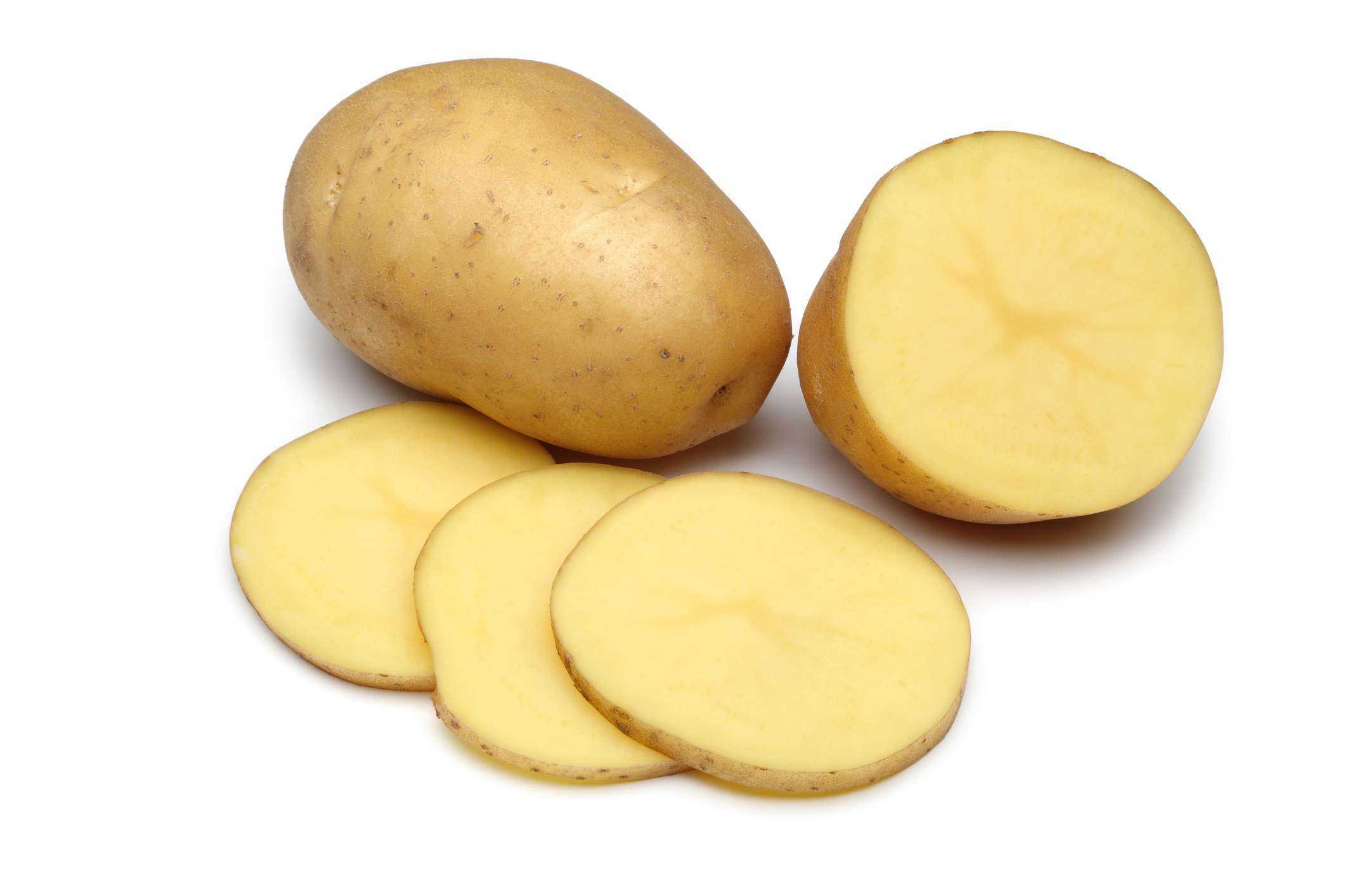 Patatas y ácido úrico